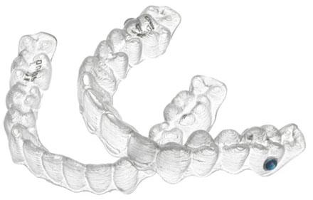 Average Cost of Braces - Best Orthodontist NYC
